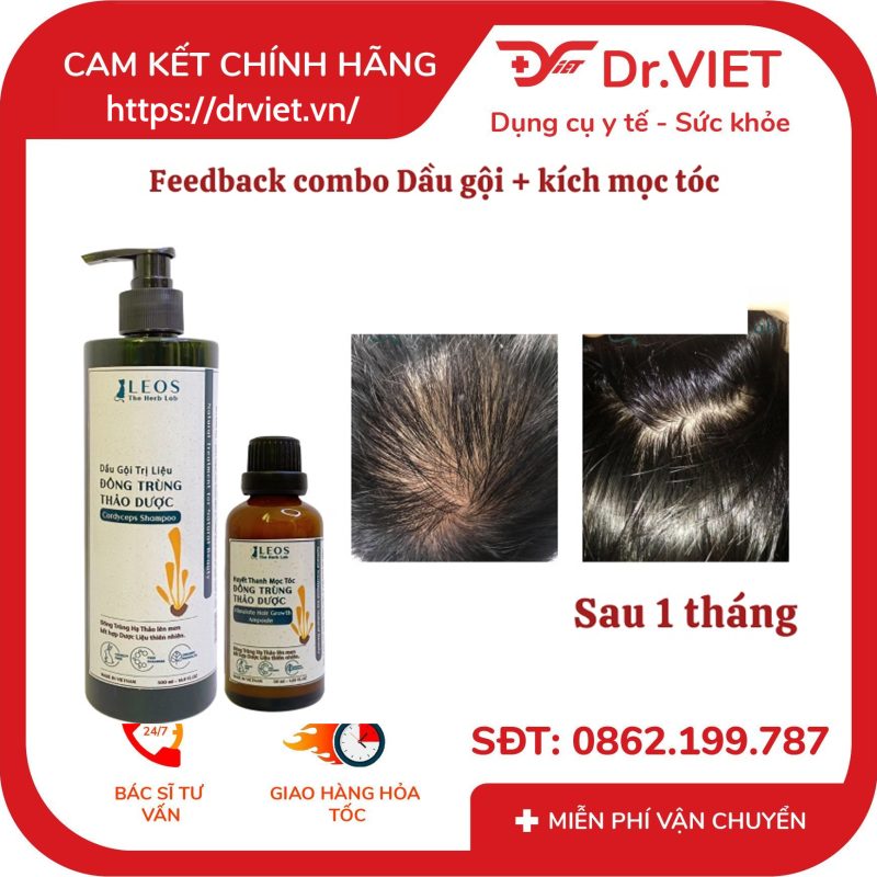 Tinh chất kích mọc tóc Đông Trùng Thảo Dược 9 Tinh chất kích mọc tóc Đông Trùng Thảo Dược