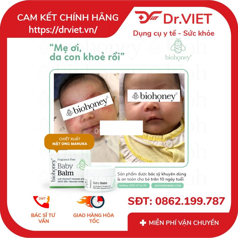 Kem Biohoney Baby Balm Giảm chàm sữa viêm da ở trẻ 10 Kem Biohoney Baby Balm Giảm chàm sữa viêm da ở trẻ