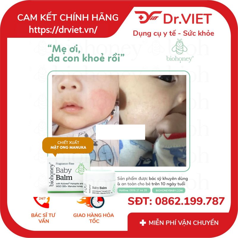 Kem Biohoney Baby Balm Giảm chàm sữa viêm da ở trẻ 13 Kem Biohoney Baby Balm Giảm chàm sữa viêm da ở trẻ