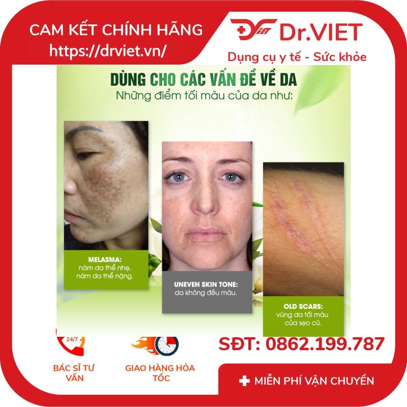 Kem Trị Nám Madeleine Ritchie Dark Spot Remover 10 Kem Trị Nám Madeleine Ritchie Dark Spot Remover