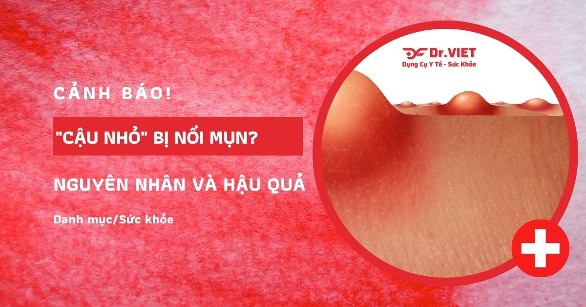 cậu nhỏ nổi mụn trắng không ngứa