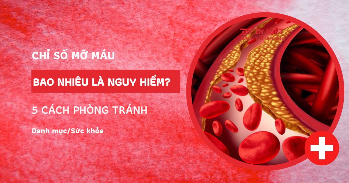 Hình đại diện chỉ số mỡ trong máu bao nhiêu là nguy hiểm