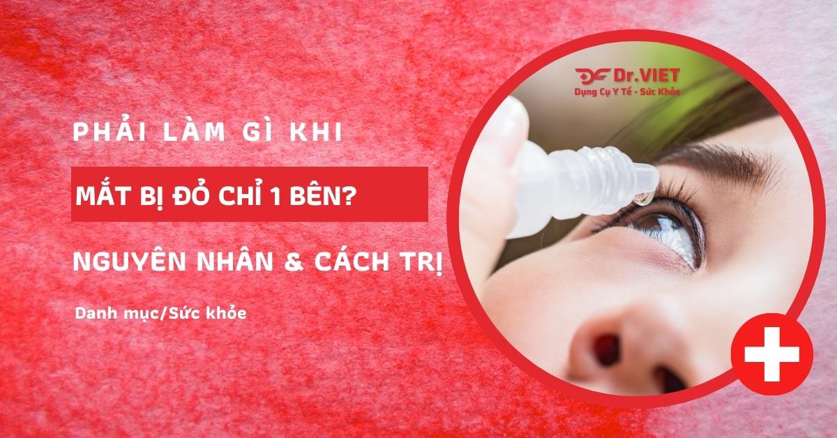 mắt bị đỏ 1 bên nhưng không đau