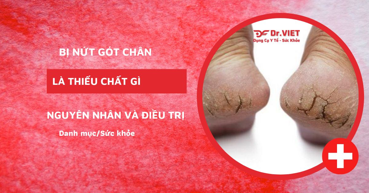 Bị nứt gót chân là thiếu chất gì