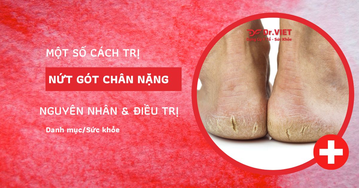 Cách trị nứt gót chân nặng an toàn