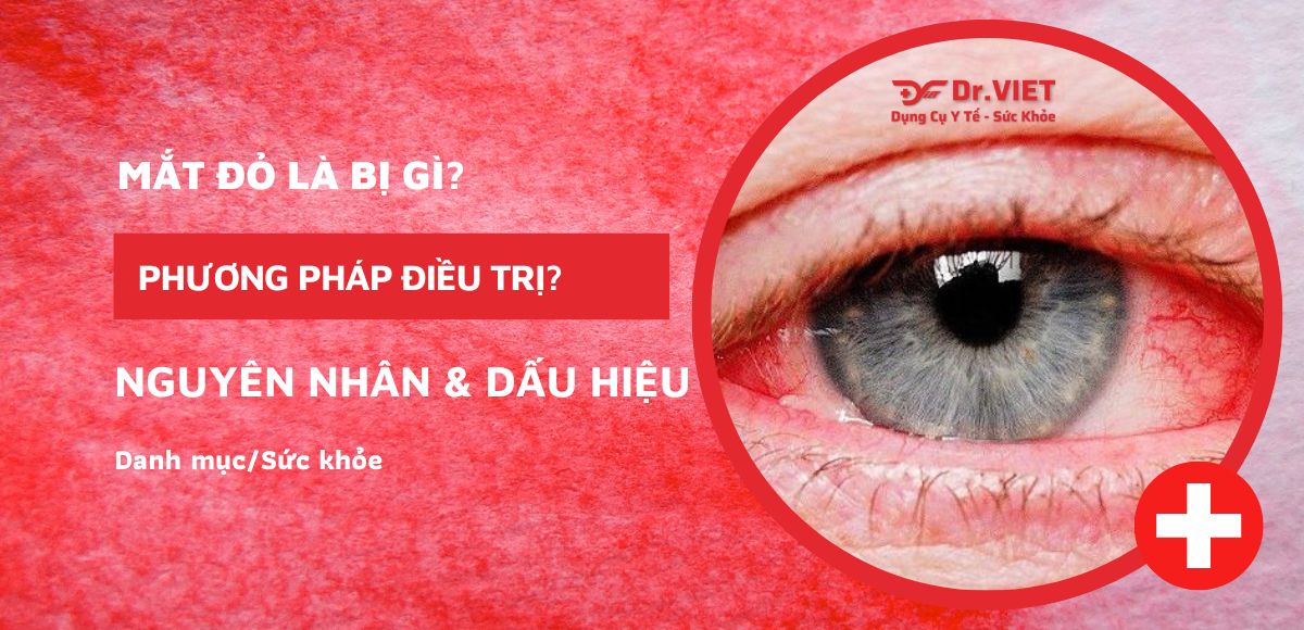 Mắt đỏ là bị gì? Nguyên nhân và dấu hiệu