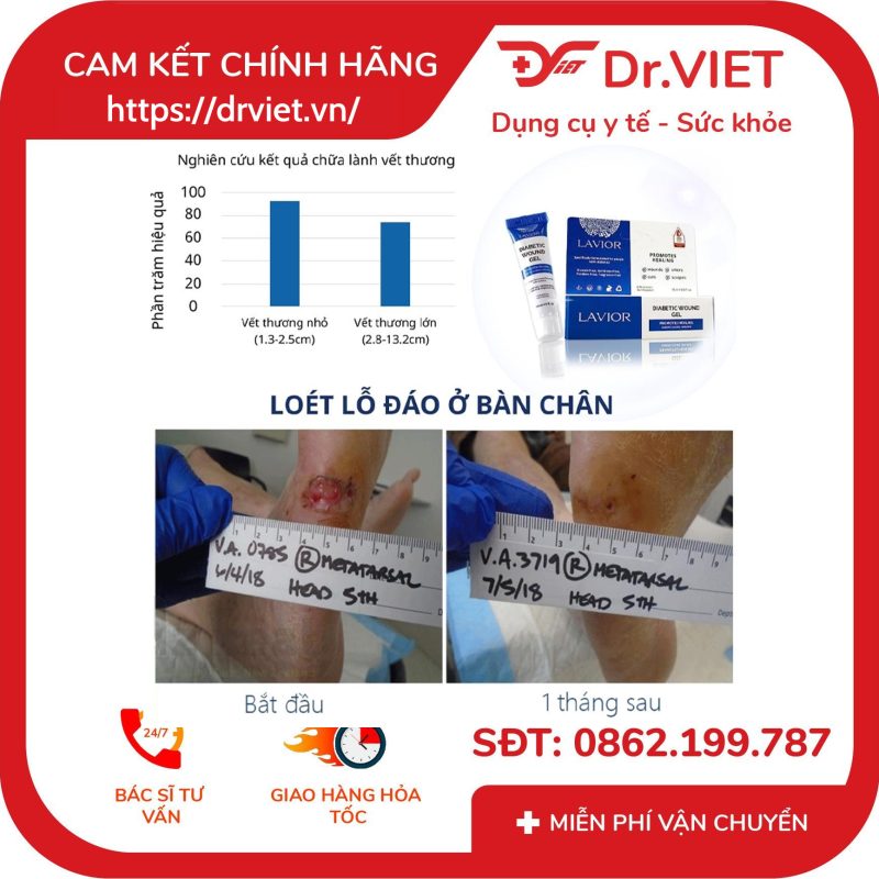 Alternative view of Kem dưỡng chống loét tì đè LAVIOR Diabetic Foot Cream 100ml