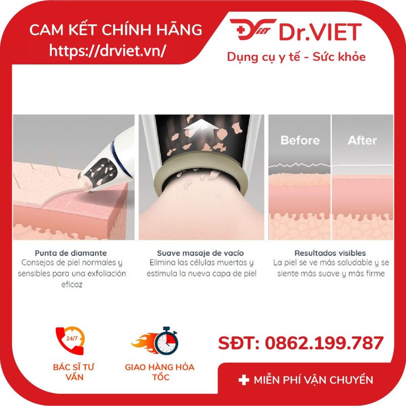 Máy tẩy tế bào chết Homedics MDA-100 siêu mài mòn kim cương trẻ hóa da 15 Máy tẩy tế bào chết Homedics MDA-100 siêu mài mòn kim cương trẻ hóa da